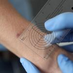 Geiserailie 4 Pcs Medical Ruler with Wound Measuring and Pupil Gauge Wound Measurement Tools for Nurses Wound Measuring Guide for Nurses Body Wound Care