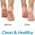 Foot Scrubber Feet Cleaner Washer Brush for Shower Floor Spas Massage, Slipper for Exfoliating Cleaning Foot