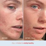 First Aid Beauty - Ultra Repair Cream, Intense Hydration Whipped Colloidal Oatmeal, Clinically Proven to Strengthen Skin Barrier in 7 Days & Helps Relieve Eczema, Luxury Face & Body Moisturizer, 12 oz