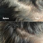 SickScience PowerCycle Exosome Hair Growth Serum - Clinically vanced Scalp Treatment for Thinning Hair, Hair Loss Prevention & Regrowth - Lightweight Formula for Women & Men, Without Minoxidil, 60mL