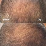 SickScience PowerCycle Exosome Hair Growth Serum - Clinically vanced Scalp Treatment for Thinning Hair, Hair Loss Prevention & Regrowth - Lightweight Formula for Women & Men, Without Minoxidil, 60mL